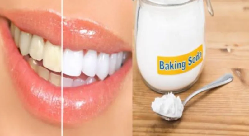 Cách làm trắng răng bằng Baking Soda có ưu điểm về chi phí và khả năng hỗ trợ làm sạch vết ố, nhưng hiệu quả hạn chế với đổi màu nằm sâu trong cấu trúc răng.