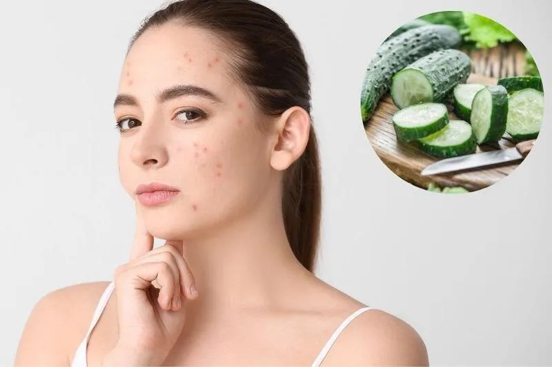 Đắp dưa leo quá thường xuyên có thể làm tăng nguy cơ kích ứng, nhiễm bẩn và chăm sóc da quá mức